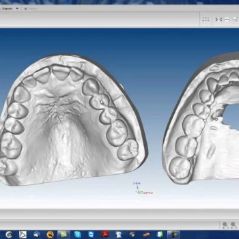 Фото ПО AGE Solutions S.r.l. Maestro 3D Ortho Studio 6