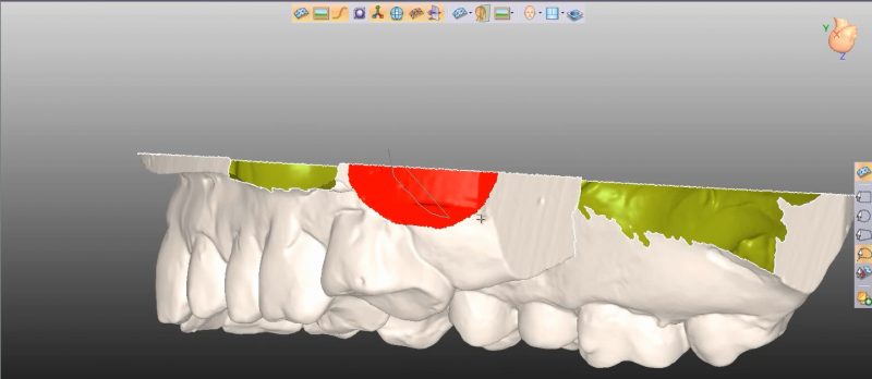 Фото ПО для стоматологии Avantis3D_1