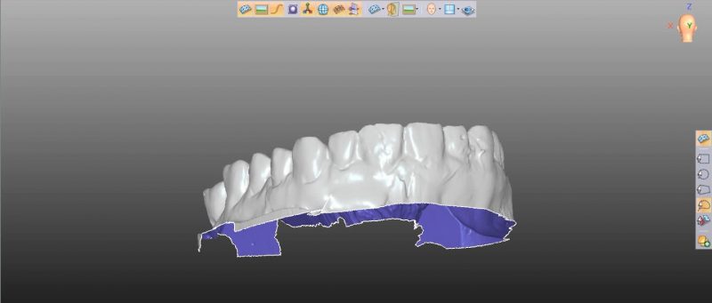 Фото ПО для стоматологии Avantis3D_3