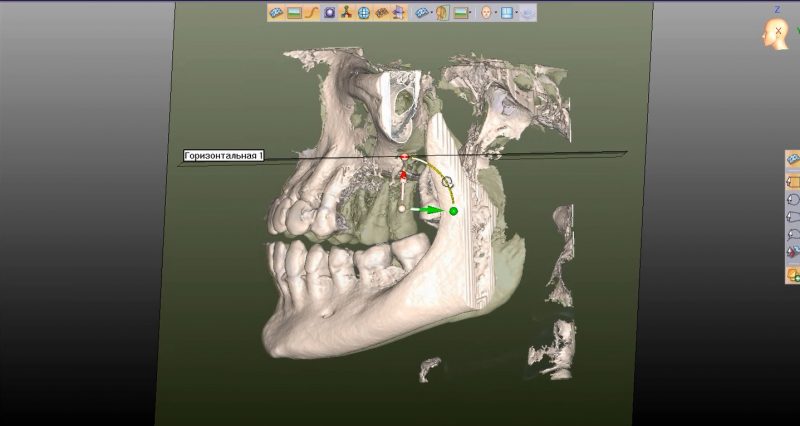 Фото ПО для стоматологии Avantis3D_4