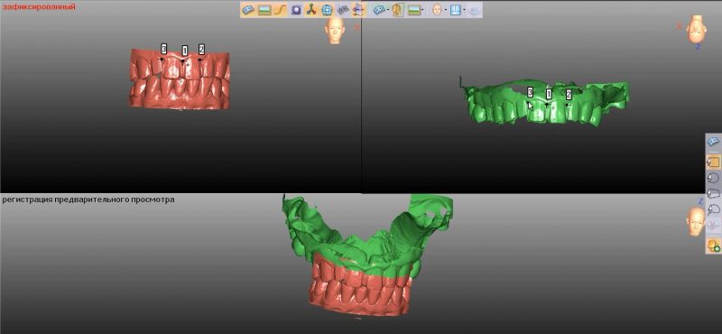 Фото ПО для стоматологии Avantis3D_5