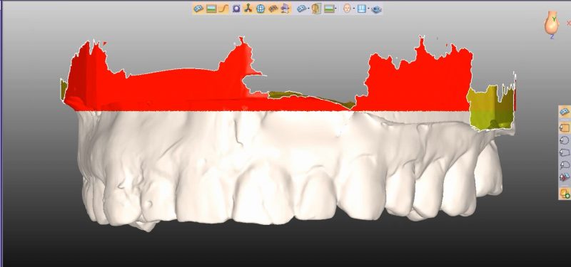 Фото ПО для стоматологии Avantis3D_6
