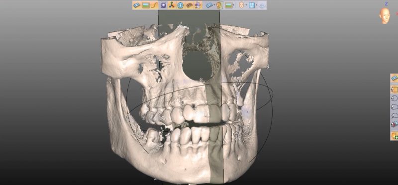 Фото ПО для стоматологии Avantis3D_7