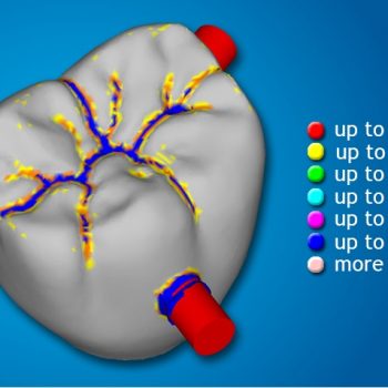 Фото ПО для стоматологии SUM 3D Dental_1