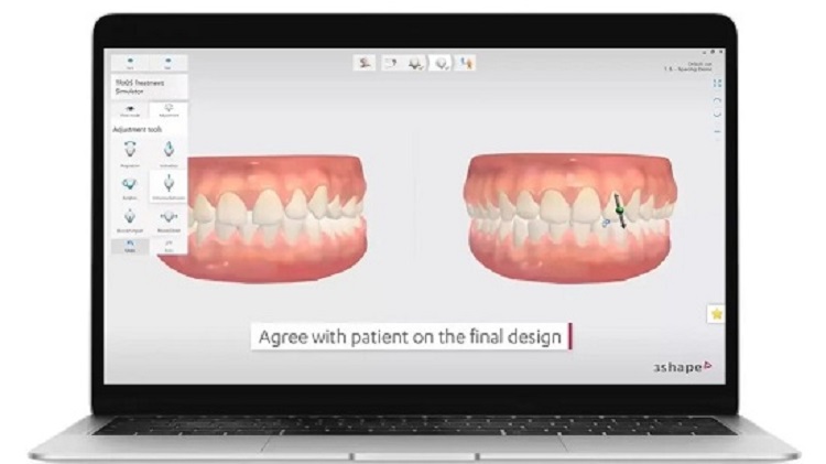 Фото 3D сканер 3Shape TRIOS 3 Cart 5